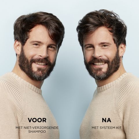 Nioxin - System 1 - Voordeelset